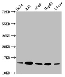 HIST1H2BN Antibody - Western Blot Positive WB detected in: Hela whole cell lysate, 293 whole cell lysate, A549 whole cell lysate, HepG2 whole cell lysate, Rat liver tissue All Lanes: HIST1H2BC antibody at 0.15µg/ml Secondary Goat polyclonal to rabbit IgG at 1/50000 dilution Predicted band size: 14 KDa Observed band size: 14 KDa