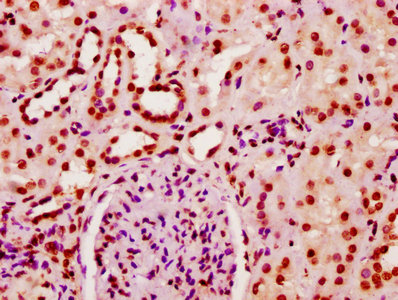 HIST1H2BN Antibody - Immunohistochemistry Dilution at 1:10 and staining in paraffin-embedded human kidney tissue performed on a Leica BondTM system. After dewaxing and hydration, antigen retrieval was mediated by high pressure in a citrate buffer (pH 6.0). Section was blocked with 10% normal Goat serum 30min at RT. Then primary antibody (1% BSA) was incubated at 4°C overnight. The primary is detected by a biotinylated Secondary antibody and visualized using an HRP conjugated SP system.
