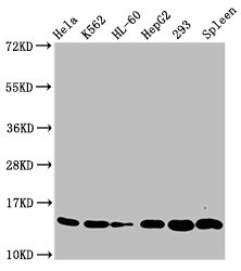 HIST1H2BN Antibody - Western Blot Positive WB detected in: Hela whole cell lysate, K562 whole cell lysate, HL-60 whole cell lysate, HepG2 whole cell lysate, 293 whole cell lysate, Rat spleen tissue All Lanes: HIST1H2BC antibody at 0.33µg/ml Secondary Goat polyclonal to rabbit IgG at 1/50000 dilution Predicted band size: 14 KDa Observed band size: 14 KDa