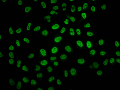 HIST1H2BN Antibody - Immunofluorescence staining of Hela cells diluted at 4°C.The Secondary antibody was Alexa Fluor 488-congugated AffiniPure Goat Anti-Rabbit IgG (H+L).