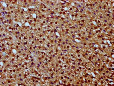 HIST1H2BN Antibody - Immunohistochemistry Dilution at 1:20 and staining in paraffin-embedded human adrenal gland tissue performed on a Leica BondTM system. After dewaxing and hydration, antigen retrieval was mediated by high pressure in a citrate buffer (pH 6.0). Section was blocked with 10% normal Goat serum 30min at RT. Then primary antibody (1% BSA) was incubated at 4°C overnight. The primary is detected by a biotinylated Secondary antibody and visualized using an HRP conjugated SP system.