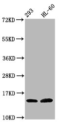 HIST1H2BN Antibody - Western Blot Positive WB detected in: 293 whole cell lysate, HL-60 whole cell lysate(all treated with 30mM sodium butyrate for 4h) All Lanes: HIST1H2BC antibody at 1.7µg/ml Secondary Goat polyclonal to rabbit IgG at 1/50000 dilution Predicted band size: 14 KDa Observed band size: 14 KDa