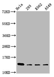 HIST1H2BN Antibody - Western Blot Positive WB detected in: Hela whole cell lysate, 293 whole cell lysate, K562 whole cell lysate, A549 whole cell lysate All Lanes: HIST1H2BC antibody at 1.1µg/ml Secondary Goat polyclonal to rabbit IgG at 1/50000 dilution Predicted band size: 14 KDa Observed band size: 14 KDa