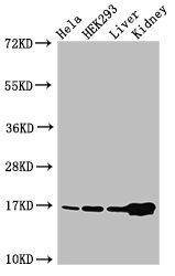 HIST1H3A Antibody - Positive Western Blot detected in Hela cell acid extracts, HEK293 cell acid extracts, Mouse liver tissue, Mouse kidney tissue. All lanes: HIST1H3A antibody at 2 µg/ml Secondary Goat polyclonal to rabbit IgG at 1/50000 dilution. Predicted band size: 16 KDa. Observed band size: 16 KDa