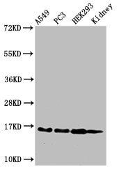HIST1H3A Antibody - Positive Western Blot detected in A549 cell acid extracts, PC3 cell acid extracts, HEK293 cell acid extracts, Mouse kidney tissue. All lanes: HIST1H3A antibody at 2 µg/ml Secondary Goat polyclonal to rabbit IgG at 1/50000 dilution. Predicted band size: 16 KDa. Observed band size: 16 KDa