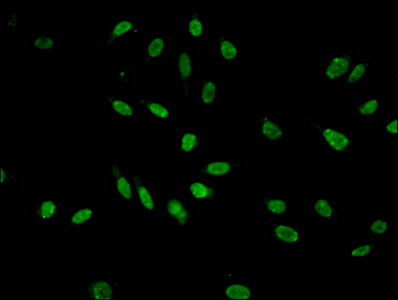 HIST1H3A Antibody - Immunofluorescent analysis of Hela cells at a dilution of 1:100 and Alexa Fluor 488-congugated AffiniPure Goat Anti-Rabbit IgG(H+L)