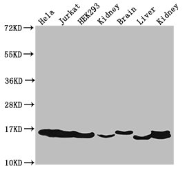 HIST1H3A Antibody - Positive Western Blot detected in Hela cell acid extracts, Jurkat cell acid extracts, HEK293 cell acid extracts, Rat kidney tissue, Mouse brain tissue, Mouse liver tissue, Mouse kidney tissue. All lanes: HIST1H3A antibody at 2 µg/ml Secondary Goat polyclonal to rabbit IgG at 1/50000 dilution. Predicted band size: 16 KDa. Observed band size: 16 KDa