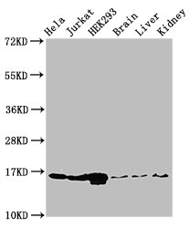 HIST1H3A Antibody - Positive Western Blot detected in Hela cell acid extracts, Jurkat cell acid extracts, HEK293 cell acid extracts, Mouse brain tissue, Mouse liver tissue, Mouse kidney tissue. All lanes: HIST1H3A antibody at 1 µg/ml Secondary Goat polyclonal to rabbit IgG at 1/50000 dilution. Predicted band size: 16 KDa. Observed band size: 16 KDa