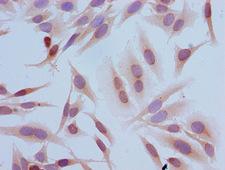 HIST1H3A Antibody - Immunocytochemistry analysis of Hela cells at a dilution of 1:100
