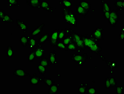 HIST1H3A Antibody - Immunofluorescence staining of Hela cells with DAPI. The cells were fixed in 4% formaldehyde, permeabilized using 0.2% Triton X-100 and blocked in 10% normal Goat Serum. The cells were then incubated with the antibody overnight at 4 °C.The secondary antibody was Alexa Fluor 488-congugated AffiniPure Goat Anti-Rabbit IgG (H+L) .