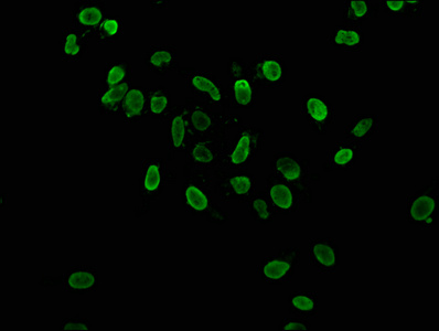 HIST1H3A Antibody - Immunofluorescence staining of Hela cells at a dilution of 1:37.5, counter-stained with DAPI. The cells were fixed in 4% formaldehyde, permeabilized using 0.2% Triton X-100 and blocked in 10% normal Goat Serum. The cells were then incubated with the antibody overnight at 4 °C.The secondary antibody was Alexa Fluor 488-congugated AffiniPure Goat Anti-Rabbit IgG (H+L) .