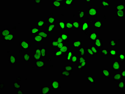 HIST1H3A Antibody - Immunofluorescence staining of Hela cells with DAPI. The cells were fixed in 4% formaldehyde, permeabilized using 0.2% Triton X-100 and blocked in 10% normal Goat Serum. The cells were then incubated with the antibody overnight at 4°C.The secondary antibody was Alexa Fluor 488-congugated AffiniPure Goat Anti-Rabbit IgG (H+L) .
