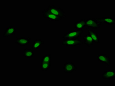 HIST1H3A Antibody - Immunofluorescence staining of Hela cells at a dilution of 1:15, counter-stained with DAPI. The cells were fixed in 4% formaldehyde, permeabilized using 0.2% Triton X-100 and blocked in 10% normal Goat Serum. The cells were then incubated with the antibody overnight at 4 °C.The secondary antibody was Alexa Fluor 488-congugated AffiniPure Goat Anti-Rabbit IgG (H+L) .