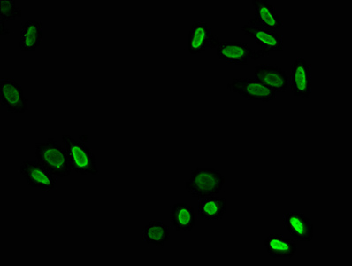 HIST1H3A Antibody - Immunofluorescence staining of Hela cells at a dilution of 1:7.5, counter-stained with DAPI. The cells were fixed in 4% formaldehyde, permeabilized using 0.2% Triton X-100 and blocked in 10% normal Goat Serum. The cells were then incubated with the antibody overnight at 4 °C.The secondary antibody was Alexa Fluor 488-congugated AffiniPure Goat Anti-Rabbit IgG (H+L) .