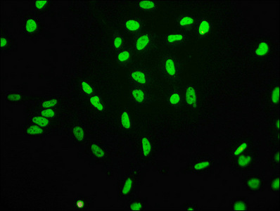 HIST1H3A Antibody - Immunofluorescence staining of Hela cells (treated by 15mM sodium butyrate for 30min) diluted at 1:68,counter-stained with DAPI. The cells were fixed in 4% formaldehyde, permeabilized using 0.2% Triton X-100 and blocked in 10% normal Goat Serum. The cells were then incubated with the antibody overnight at 4°C.The Secondary antibody was Alexa Fluor 488-congugated AffiniPure Goat Anti-Rabbit IgG (H+L).