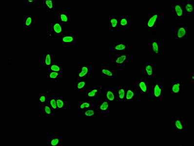HIST1H3A Antibody - Immunofluorescence staining of Hela cells (treated by 15mM sodium butyrate for 30min) diluted at 1:43,counter-stained with DAPI. The cells were fixed in 4% formaldehyde, permeabilized using 0.2% Triton X-100 and blocked in 10% normal Goat Serum. The cells were then incubated with the antibody overnight at 4°C.The Secondary antibody was Alexa Fluor 488-congugated AffiniPure Goat Anti-Rabbit IgG (H+L).