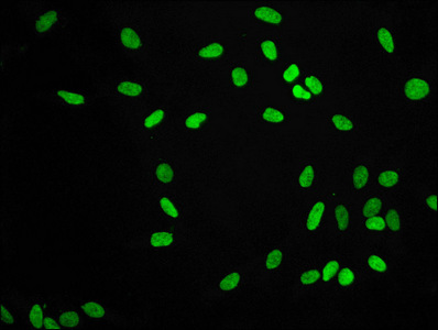 HIST1H3A Antibody - Immunofluorescence staining of Hela cells diluted at 1:56,counter-stained with DAPI. The cells were fixed in 4% formaldehyde, permeabilized using 0.2% Triton X-100 and blocked in 10% normal Goat Serum. The cells were then incubated with the antibody overnight at 4°C.The Secondary antibody was Alexa Fluor 488-congugated AffiniPure Goat Anti-Rabbit IgG (H+L).