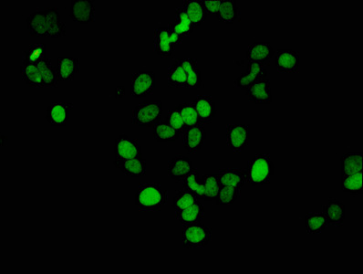 HIST1H3A Antibody - Immunofluorescence staining of Hela cells (treated by 15mM sodium butyrate for 30min) diluted at 1:46,counter-stained with DAPI. The cells were fixed in 4% formaldehyde, permeabilized using 0.2% Triton X-100 and blocked in 10% normal Goat Serum. The cells were then incubated with the antibody overnight at 4°C.The Secondary antibody was Alexa Fluor 488-congugated AffiniPure Goat Anti-Rabbit IgG (H+L).