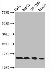 HIST1H3A Antibody - Western Blot Positive WB detected in:Hela whole cell lysate, HepG2 whole cell lysate, SH-SY5Y whole cell lysate, Rat brain tissue All Lanes:Acetyl-Histone H3.1 (K14) antibody at 0.75µg/ml Secondary Goat polyclonal to rabbit IgG at 1/50000 dilution Predicted band size: 15 KDa Observed band size: 15 KDa