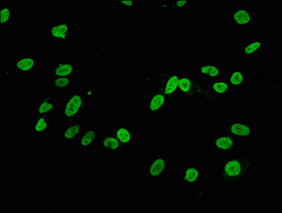 HIST1H3A Antibody - Immunofluorescence staining of Hela cells diluted at 1:34,counter-stained with DAPI. The cells were fixed in 4% formaldehyde, permeabilized using 0.2% Triton X-100 and blocked in 10% normal Goat Serum. The cells were then incubated with the antibody overnight at 4°C.The Secondary antibody was Alexa Fluor 488-congugated AffiniPure Goat Anti-Rabbit IgG (H+L).