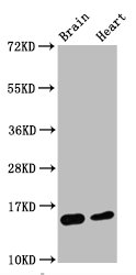 HIST1H3A Antibody - Western Blot Positive WB detected in:Mouse brain tissue,Mouse heart tissue All Lanes:Di-methyl-Histone H3.1 (K4) antibody at 0.55µg/ml Secondary Goat polyclonal to rabbit IgG at 1/50000 dilution Predicted band size: 15 KDa Observed band size: 15 KDa