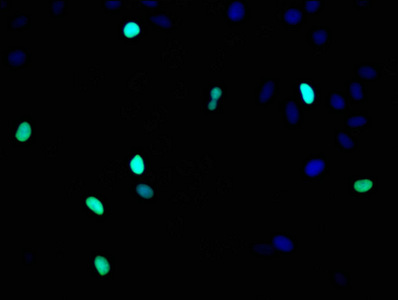 HIST1H3A Antibody - Immunofluorescence staining of Hela cells with Histone H3.1 Antibody at 1:93,counter-stained with DAPI. The cells were fixed in 4% formaldehyde, permeabilized using 0.2% Triton X-100 and blocked in 10% normal Goat Serum. The cells were then incubated with the antibody overnight at 4°C.The secondary antibody was Alexa Fluor 488-congugated AffiniPure Goat Anti-Rabbit IgG (H+L).