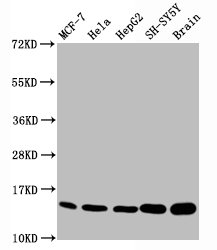 HIST1H3A Antibody - Western Blot Positive WB detected in:MCF-7 whole cell lysate, Hela whole cell lysate, HepG2 whole cell lysate, SH-SY5Y whole cell lysate,Rat brain tissue All Lanes:Mono-methyl-Histone H3.1 (K18) antibody at 0.7µg/ml Secondary Goat polyclonal to rabbit IgG at 1/50000 dilution Predicted band size: 15 KDa Observed band size: 15 KDa