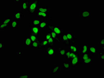 HIST1H3A Antibody - Immunofluorescence staining of Hela cells diluted at 1:37.5,counter-stained with DAPI. The cells were fixed in 4% formaldehyde, permeabilized using 0.2% Triton X-100 and blocked in 10% normal Goat Serum. The cells were then incubated with the antibody overnight at 4°C.The Secondary antibody was Alexa Fluor 488-congugated AffiniPure Goat Anti-Rabbit IgG (H+L).