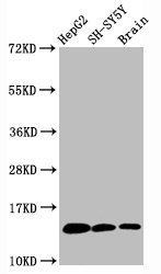 HIST1H3A Antibody - Western Blot Positive WB detected in:HepG2 whole cell lysate, SH-SY5Y whole cell lysate, Rat brain tissue All Lanes:Mono-methyl-Histone H3.1 (K36) antibody at 0.6µg/ml Secondary Goat polyclonal to rabbit IgG at 1/50000 dilution Predicted band size: 15 KDa Observed band size: 15 KDa