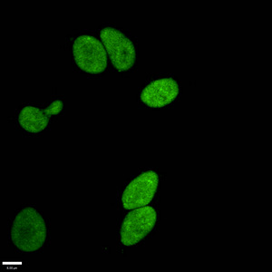 HIST1H3A Antibody - Immunofluorescence staining of Hela cells with at dilution of 1:96,counter-stained with DAPI. The cells were fixed in 4% formaldehyde, permeabilized using 0.2% Triton X-100 and blocked in 10% normal Goat Serum. The cells were then incubated with the antibody overnight at 4°C.The Secondary antibody was Alexa Fluor 488-congugated AffiniPure Goat Anti-Rabbit IgG (H+L).