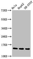HIST1H3A Antibody - Western Blot Positive WB detected in:Hela whole cell lysate, HepG2 whole cell lysate, SH-SY5Y whole cell lysate All Lanes:Mono-methyl-Histone H3.1 (R17) antibody at 1.55µg/ml Secondary Goat polyclonal to rabbit IgG at 1/50000 dilution Predicted band size: 15 KDa Observed band size: 15 KDa