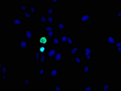 HIST1H3A Antibody - Immunofluorescence staining of Hela cells diluted at 1:31,counter-stained with DAPI. The cells were fixed in 4% formaldehyde, permeabilized using 0.2% Triton X-100 and blocked in 10% normal Goat Serum. The cells were then incubated with the antibody overnight at 4°C.The Secondary antibody was Alexa Fluor 488-congugated AffiniPure Goat Anti-Rabbit IgG (H+L).