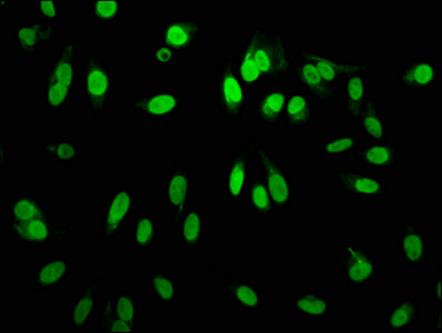 HIST1H3A Antibody - Immunofluorescence staining of Hela cells diluted at 1:60,counter-stained with DAPI. The cells were fixed in 4% formaldehyde, permeabilized using 0.2% Triton X-100 and blocked in 10% normal Goat Serum. The cells were then incubated with the antibody overnight at 4°C.The Secondary antibody was Alexa Fluor 488-congugated AffiniPure Goat Anti-Rabbit IgG (H+L).
