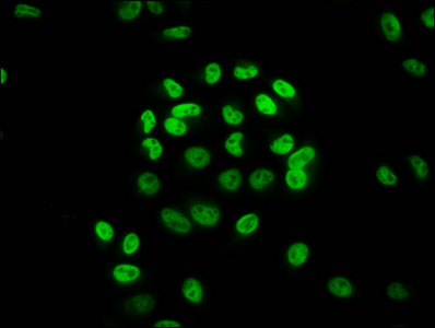 HIST1H3A Antibody - Immunofluorescence staining of Hela cells (treated with 30mM sodium butyrate for 4h) diluted at 1:20, counter-stained with DAPI. The cells were fixed in 4% formaldehyde, permeabilized using 0.2% Triton X-100 and blocked in 10% normal Goat Serum. The cells were then incubated with the antibody overnight at 4°C.The Secondary antibody was Alexa Fluor 488-congugated AffiniPure Goat Anti-Rabbit IgG (H+L) .