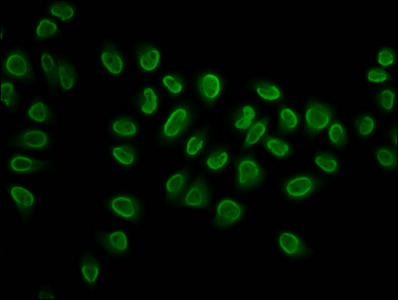 HIST1H3A Antibody - Immunofluorescence staining of Hela cells (treated with 30mM sodium butyrate for 4h) diluted at 1:5, counter-stained with DAPI. The cells were fixed in 4% formaldehyde, permeabilized using 0.2% Triton X-100 and blocked in 10% normal Goat Serum. The cells were then incubated with the antibody overnight at 4°C.The Secondary antibody was Alexa Fluor 488-congugated AffiniPure Goat Anti-Rabbit IgG (H+L) .