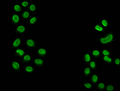 HIST1H3A Antibody - Immunofluorescence staining of Hela cells (treated with 30mM sodium butyrate for 4h) diluted at 1:50, counter-stained with DAPI. The cells were fixed in 4% formaldehyde, permeabilized using 0.2% Triton X-100 and blocked in 10% normal Goat Serum. The cells were then incubated with the antibody overnight at 4°C.The Secondary antibody was Alexa Fluor 488-congugated AffiniPure Goat Anti-Rabbit IgG (H+L) .
