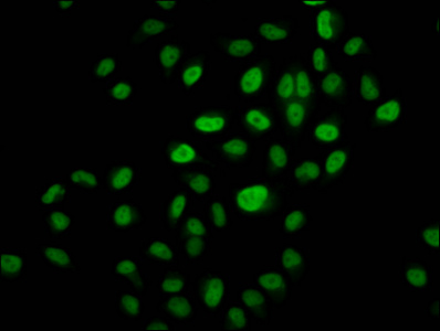 HIST1H3A Antibody - Immunofluorescence staining of Hela cells (treated with 30mM sodium butyrate for 4h) diluted at 1:10, counter-stained with DAPI. The cells were fixed in 4% formaldehyde, permeabilized using 0.2% Triton X-100 and blocked in 10% normal Goat Serum. The cells were then incubated with the antibody overnight at 4°C.The Secondary antibody was Alexa Fluor 488-congugated AffiniPure Goat Anti-Rabbit IgG (H+L) .