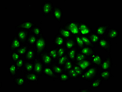 HIST1H3A Antibody - Immunofluorescence staining of Hela cells (treated with 30mM sodium butyrate for 4h) diluted at 1:20, counter-stained with DAPI. The cells were fixed in 4% formaldehyde, permeabilized using 0.2% Triton X-100 and blocked in 10% normal Goat Serum. The cells were then incubated with the antibody overnight at 4°C.The Secondary antibody was Alexa Fluor 488-congugated AffiniPure Goat Anti-Rabbit IgG (H+L) .