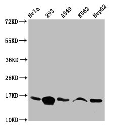 HIST1H3A Antibody - Western Blot Positive WB detected in: Hela whole cell lysate, 293 whole cell lysate, A549 whole cell lysate, K562 whole cell lysate, HepG2 whole cell lysate(all treated with 30mM sodium butyrate for 4h) All Lanes: HIST1H3A antibody at 1µg/ml Secondary Goat polyclonal to rabbit IgG at 1/50000 dilution Predicted band size: 16 KDa Observed band size: 16 KDa