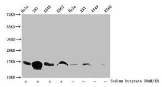 HIST1H3A Antibody - Western Blot Detected samples: Hela whole cell lysate, 293 whole cell lysate, A549 whole cell lysate, K562 whole cell lysate; Untreated (-) or treated (+) with 30mM sodium butyrate for 4h All lanes: HIST1H3A antibody at 1:100 Secondary Goat polyclonal to rabbit IgG at 1/50000 dilution Predicted band size: 16 kDa Observed band size: 16 kDa