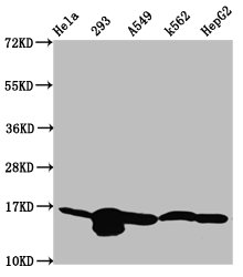 HIST1H3A Antibody - Western Blot Positive WB detected in: Hela whole cell lysate, 293 whole cell lysate, A549 whole cell lysate, K562 whole cell lysate, HepG2 whole cell lysate(all treated with 30mM sodium butyrate for 4h) All Lanes: HIST1H3A antibody at 1.2µg/ml Secondary Goat polyclonal to rabbit IgG at 1/50000 dilution Predicted band size: 16 KDa Observed band size: 16 KDa