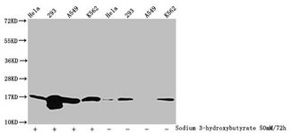HIST1H3A Antibody - Western Blot Detected samples: Hela whole cell lysate, 293 whole cell lysate, A549 whole cell lysate, K562 whole cell lysate; Untreated (-) or treated (+) with 50mM Sodium 3-hydroxybutyrate for 72h All lanes: HIST1H3A antibody at 1:100 Secondary Goat polyclonal to rabbit IgG at 1/50000 dilution Predicted band size: 16 kDa Observed band size: 16 kDa