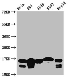 HIST1H3A Antibody - Western Blot Positive WB detected in: Hela whole cell lysate, 293 whole cell lysate, A549 whole cell lysate, K562 whole cell lysate, HepG2 whole cell lysate (all treated with 30mM sodium butyrate for 4h) All Lanes: HIST1H3A antibody at 1.9µg/ml Secondary Goat polyclonal to rabbit IgG at 1/50000 dilution Predicted band size: 16 KDa Observed band size: 16 KDa