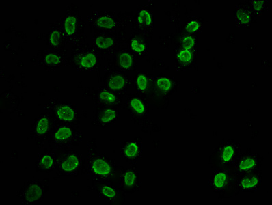 HIST1H3A Antibody - Immunofluorescence staining of Hela cells (treated with 30mM sodium butyrate for 4h) diluted at 1:100, counter-stained with DAPI. The cells were fixed in 4% formaldehyde, permeabilized using 0.2% Triton X-100 and blocked in 10% normal Goat Serum. The cells were then incubated with the antibody overnight at 4°C.The Secondary antibody was Alexa Fluor 488-congugated AffiniPure Goat Anti-Rabbit IgG (H+L) .