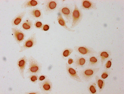HIST1H3A Antibody - Immunocytochemistry analysis diluted at 1:50 and staining in Hela cells(treated with 30mM sodium butyrate for 4h) performed on a Leica BondTM system. The cells were fixed in 4% formaldehyde, permeabilized using 0.2% Triton X-100 and blocked with 10% normal Goat serum 30min at RT. Then primary antibody (1% BSA) was incubated at 4°C overnight. The primary is detected by a biotinylated Secondary antibody and visualized using an HRP conjugated SP system.