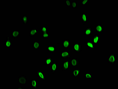 HIST1H3A Antibody - Immunofluorescence staining of Hela cells (treated with 30mM sodium butyrate for 4h) diluted at 1:25, counter-stained with DAPI. The cells were fixed in 4% formaldehyde, permeabilized using 0.2% Triton X-100 and blocked in 10% normal Goat Serum. The cells were then incubated with the antibody overnight at 4°C.The Secondary antibody was Alexa Fluor 488-congugated AffiniPure Goat Anti-Rabbit IgG (H+L) .