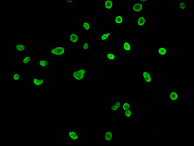 HIST1H3A Antibody - Immunofluorescence staining of Hela cells (treated with 30mM sodium butyrate for 4h) diluted at 1:15, counter-stained with DAPI. The cells were fixed in 4% formaldehyde, permeabilized using 0.2% Triton X-100 and blocked in 10% normal Goat Serum. The cells were then incubated with the antibody overnight at 4°C.The Secondary antibody was Alexa Fluor 488-congugated AffiniPure Goat Anti-Rabbit IgG (H+L) .