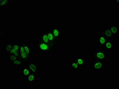 HIST1H3A Antibody - Immunofluorescence staining of HepG2 cells with HIST1H3A (Ab-27) Antibody at 1:12.5, counter-stained with DAPI. The cells were fixed in 4% formaldehyde, permeabilized using 0.2% Triton X-100 and blocked in 10% normal Goat Serum. The cells were then incubated with the antibody overnight at 4°C. The secondary antibody was Alexa Fluor 488-congugated AffiniPure Goat Anti-Rabbit IgG(H+L).