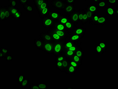 HIST1H3A Antibody - Immunofluorescence staining of HepG2 cells diluted at 1:7.5, counter-stained with DAPI. The cells were fixed in 4% formaldehyde, permeabilized using 0.2% Triton X-100 and blocked in 10% normal Goat Serum. The cells were then incubated with the antibody overnight at 4°C.The Secondary antibody was Alexa Fluor 488-congugated AffiniPure Goat Anti-Rabbit IgG (H+L).