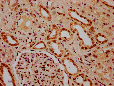 HIST1H3A Antibody - Immunohistochemistry Dilution at 1:20 and staining in paraffin-embedded human kidney tissue performed on a Leica BondTM system. After dewaxing and hydration, antigen retrieval was mediated by high pressure in a citrate buffer (pH 6.0). Section was blocked with 10% normal Goat serum 30min at RT. Then primary antibody (1% BSA) was incubated at 4°C overnight. The primary is detected by a biotinylated Secondary antibody and visualized using an HRP conjugated SP system.